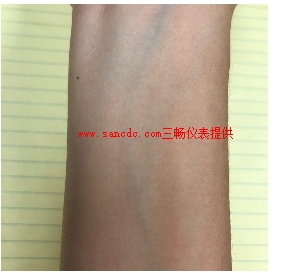 依靠线圈和电极的电磁流量计是一种测量患者血管流量的无创方式